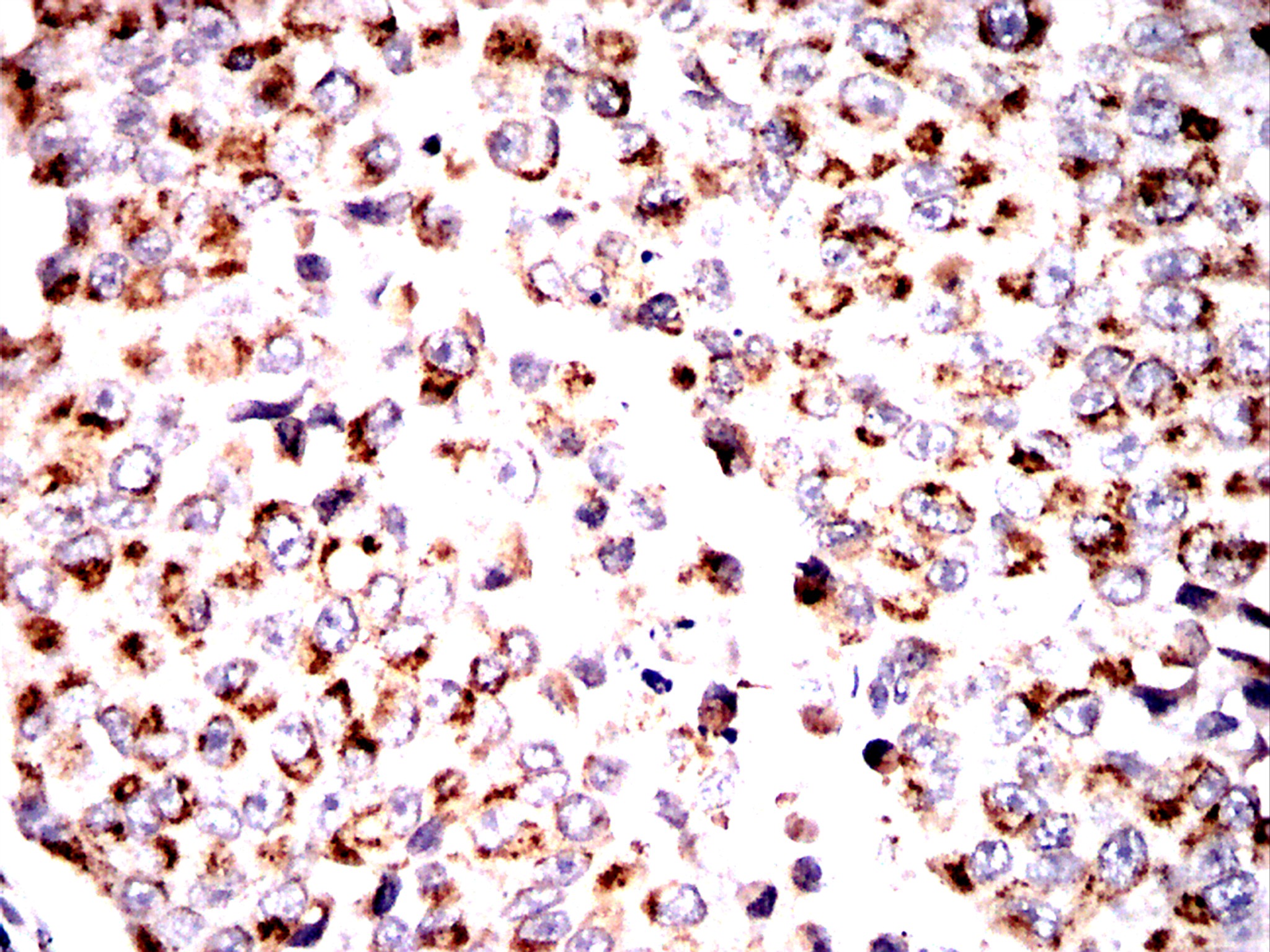 IHC